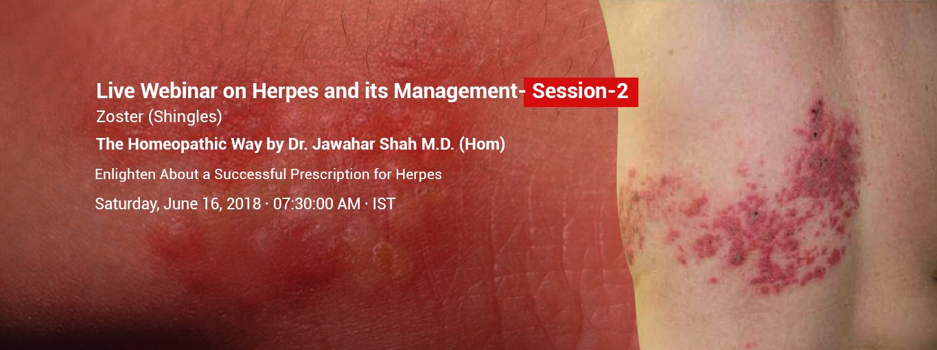 Herpes and its Management- Session 2